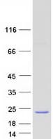 Human MED21 Protein (Recombinant Myc-DDK (Flag))