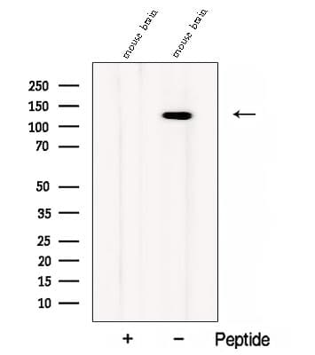 CC2D1B Antibody