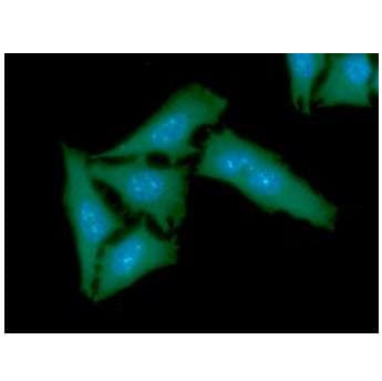 TBCB / CKAP1 Antibody (clone AT1F6)