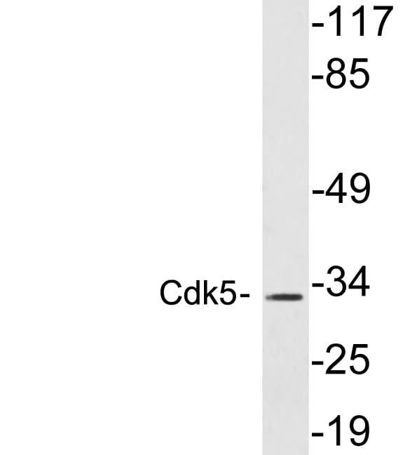 CDK5 Antibody (aa15-64)