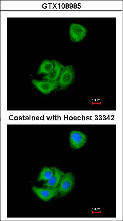 AG3 / AGR3 Antibody (aa1-166)