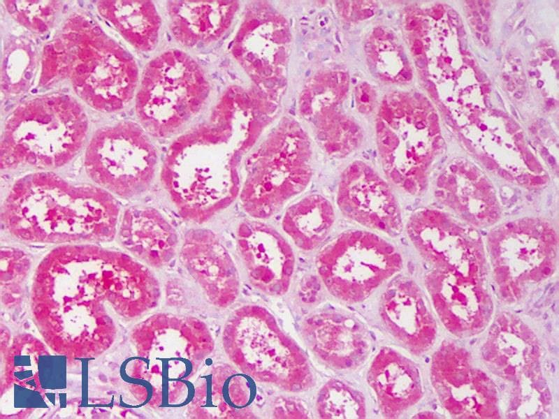 IHC-plus™ Polyclonal Rabbit anti-Human TNK2 / ACK1 Antibody (aa278-289, IHC, WB)