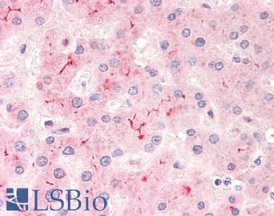 IHC-plus™ ABCB4 / MDR3 Antibody