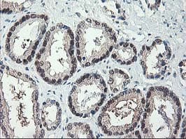 ALS2CR1 / NIF3L1 Antibody (clone OTI1F6)