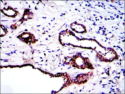 PKN2 Antibody (clone 1D1)