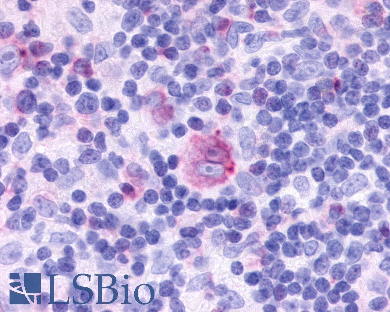 IHC-plus™ CCRL2 Antibody (Cytoplasmic Domain)