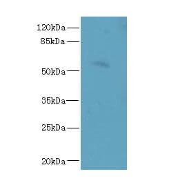 ZCCHC4 Antibody