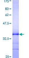 Human TNFRSF1A / TNFR1 Protein (Recombinant GST, N-terminus)