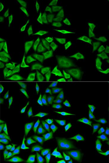 DBI / ACBD1 Antibody