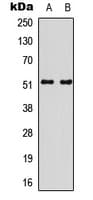 Polyclonal Rabbit anti-Human SMAD3 Antibody (phospho-Ser213, IHC, IF, WB)