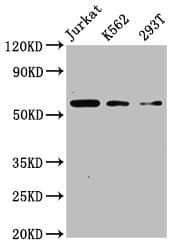 Polyclonal Rabbit anti-Human CFLAR / FLIP Antibody (IHC, WB)