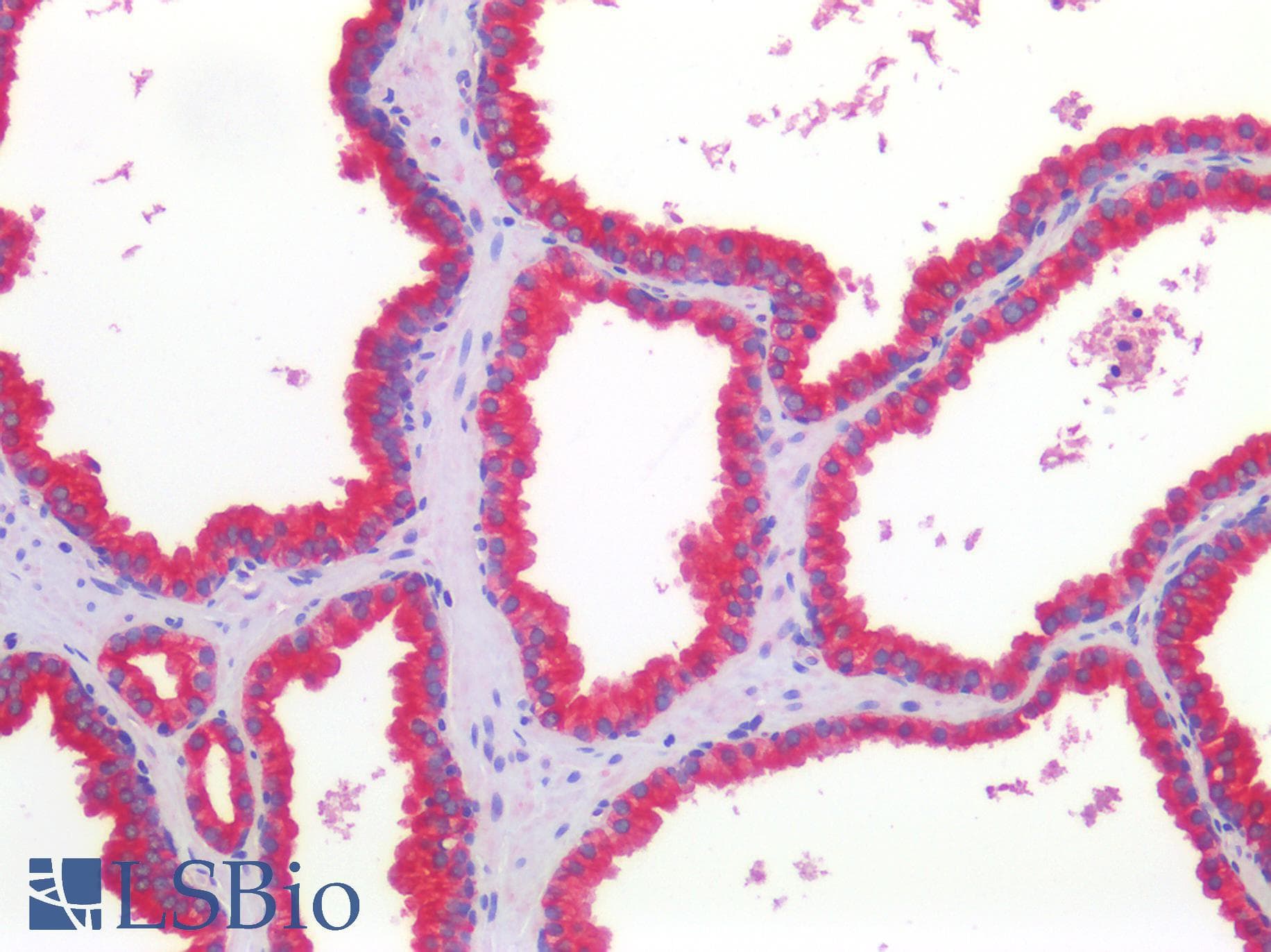 FOLR1 / Folate Receptor Alpha Antibody (aa179-228)
