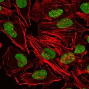 XRCC5 / Ku80 Antibody (clone 5C5)