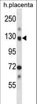 NEK9 Antibody (aa503-530)