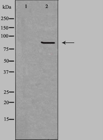 CPT1B Antibody