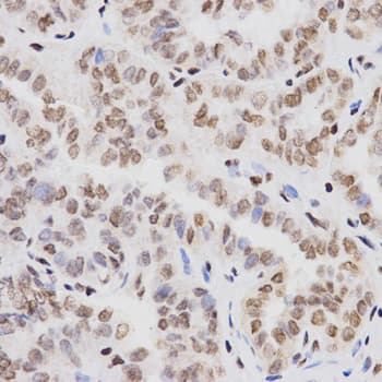 Histone H3 Antibody (Methyl-Lys4)