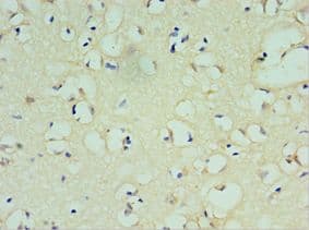SOX6 Antibody (aa1-74)