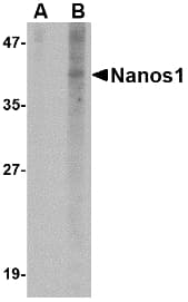Polyclonal Rabbit anti-Human NANOS1 / NOS1 Antibody (IHC, IF, WB)