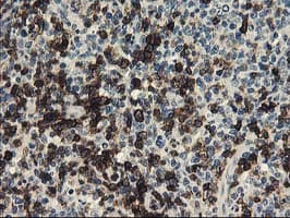 UNG / Uracil DNA Glycosylase Antibody (clone OTI1A11)