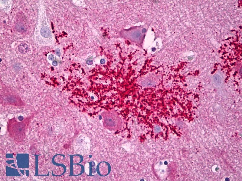 IHC-plus™ Polyclonal Rabbit anti-Human CXCR4 Antibody (aa300-349, IHC, IF, WB)
