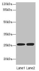 N6AMT2 Antibody (aa2-214)