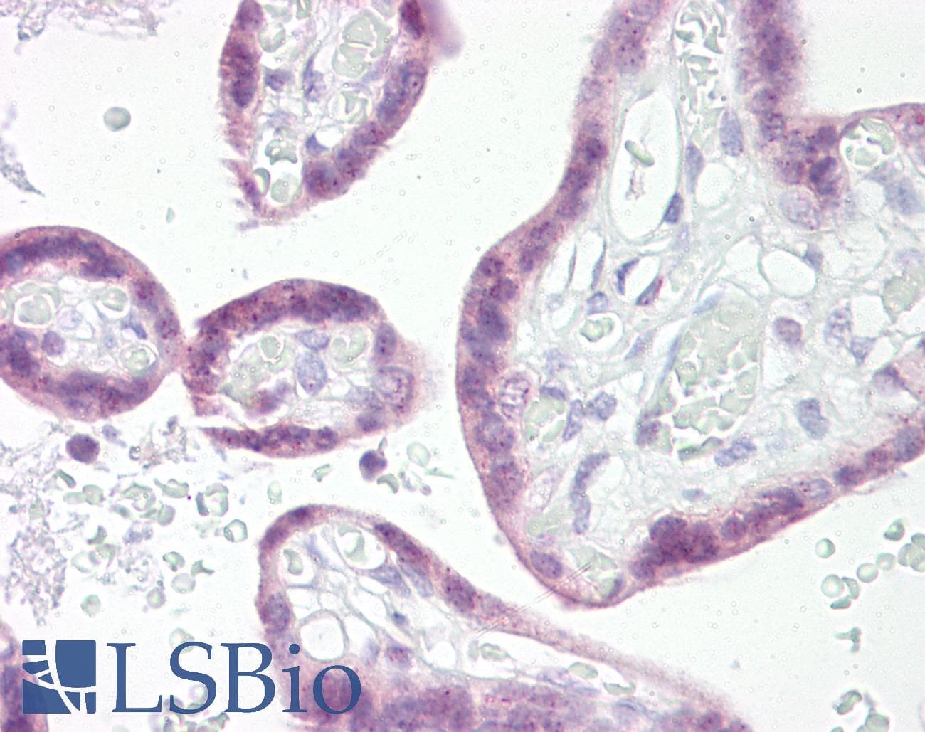 SNAI1 / SNAIL-1 Antibody (aa1-50)