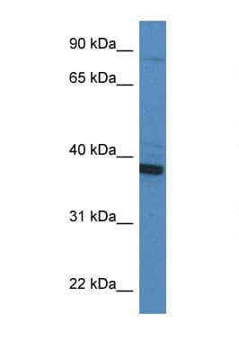 CYB5R3 / B5R Antibody (aa191-240)