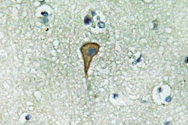IL20RA Antibody (Val222)