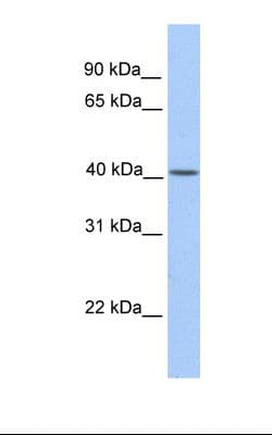 CYTB / MT-CYB Antibody (N-Terminus)