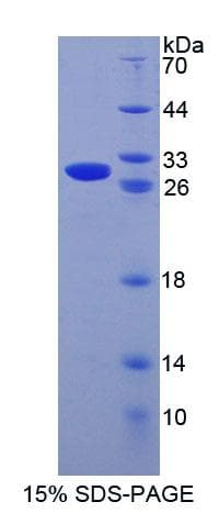 Mouse CRISP1 Protein (Recombinant His-T7)