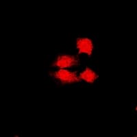 Polyclonal Rabbit anti-Human JADE1 / PHF17 Antibody (IF, WB)