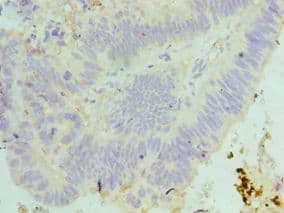 MAD2L1 / MAD2 Antibody (aa1-205)