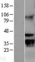 GNB2L1 / RACK1 Protein (Over-Expression Lysate Myc-DDK (Flag))