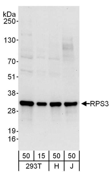 IHC-plus™ RPS3 / Ribosomal Protein S3 Antibody (aa193-243)