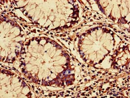 Polyclonal Rabbit anti-Human RARS Antibody