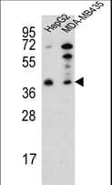 PARP16 Antibody (aa215-244)