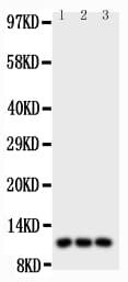 Polyclonal Rabbit anti-Human I-309 / CCL1 Antibody (aa24-96, WB)