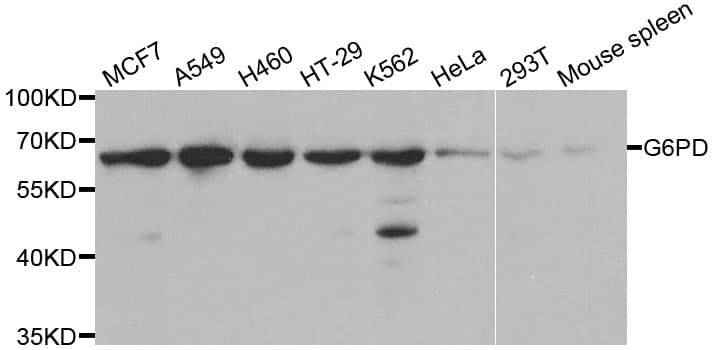 G6PD Antibody