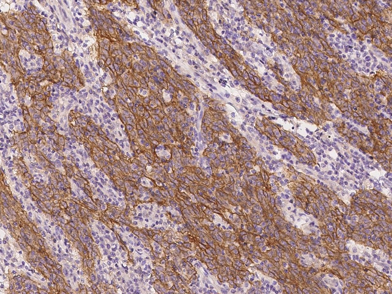 Polyclonal Rabbit anti-Human EGFR Antibody (IHC)