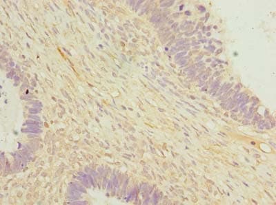 OTUD6B Antibody