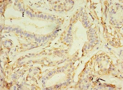Polyclonal Rabbit anti-Human NAIF1 Antibody (IHC, WB)