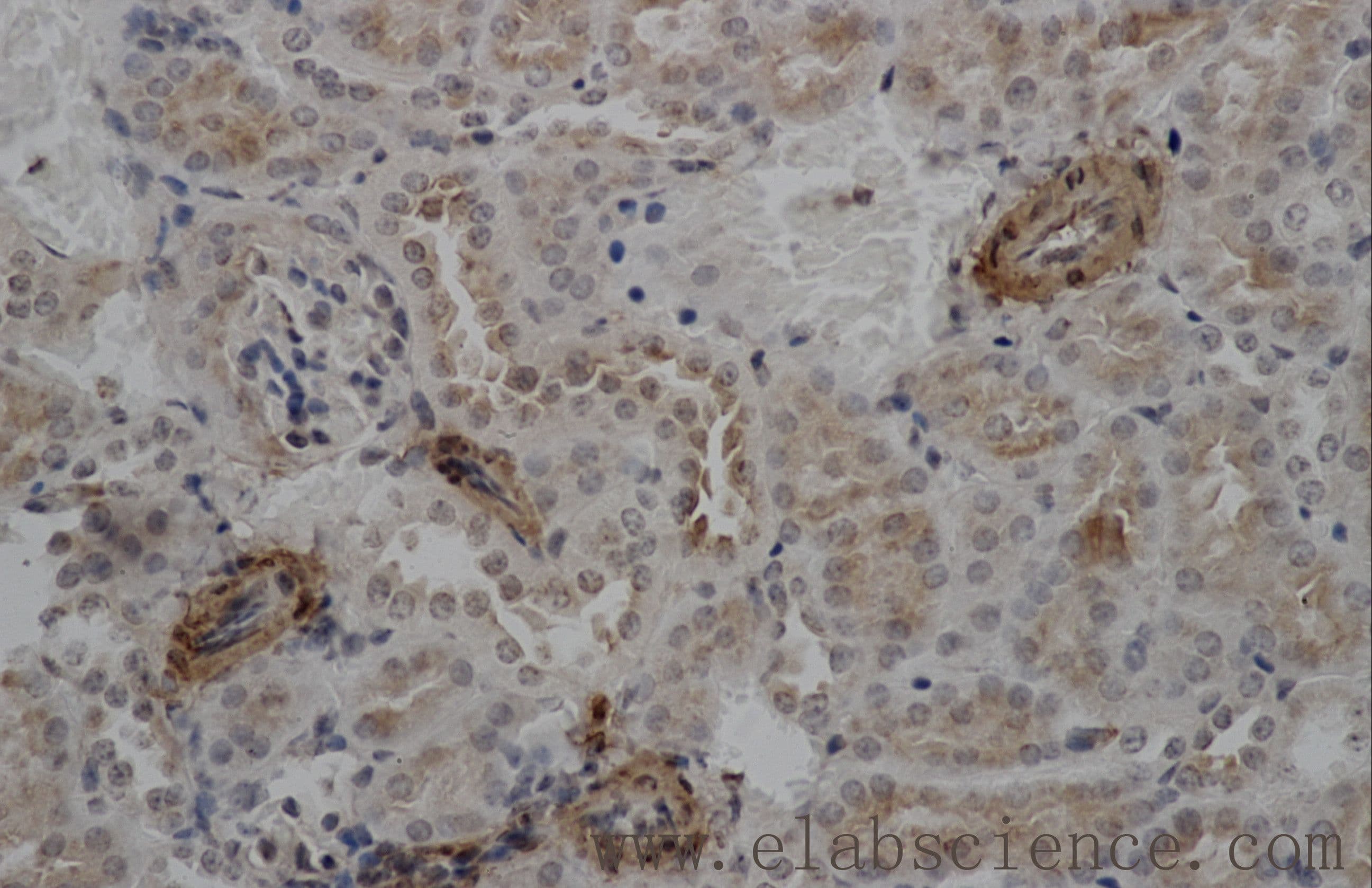 ACTA2 / Smooth Muscle Actin Antibody