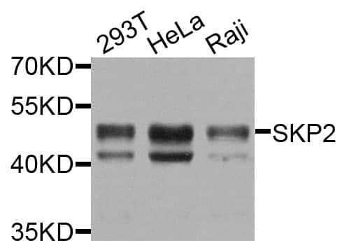 SKP2 Antibody