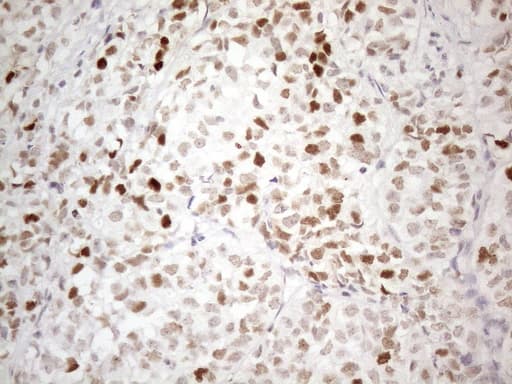 CDKN1A / WAF1 / p21 Antibody (aa2-164, clone OTI7C8)