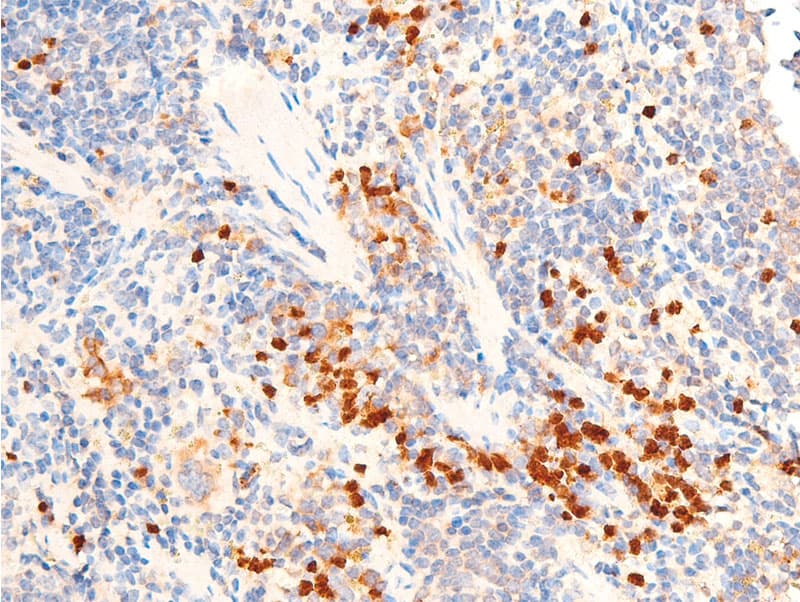 TGFB1 / TGF Beta 1 Antibody