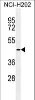 IHC-plus™ Polyclonal Rabbit anti-Human TMPRSS11E Antibody (aa249-277, IHC, WB)