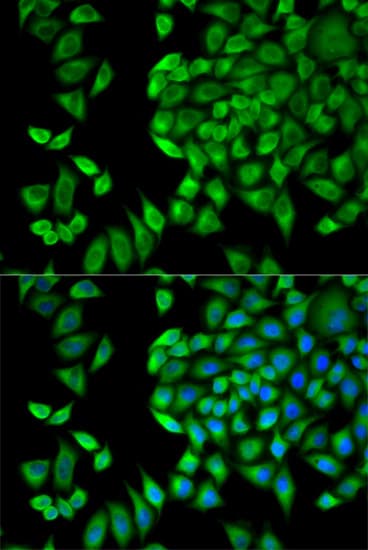 WNK1 Antibody