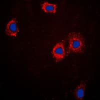 TNNI3 / Cardiac Troponin I Antibody (Internal)