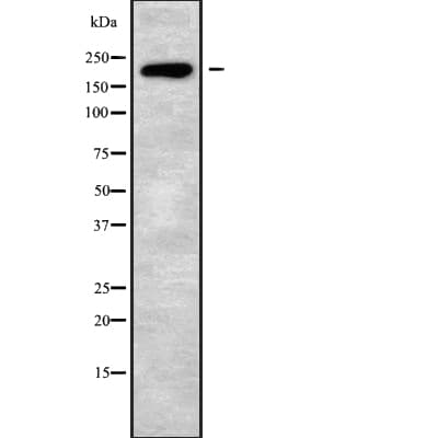 AGRN / Agrin Antibody