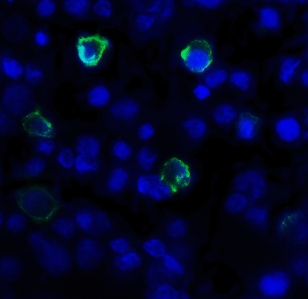 IHC-plus™ TIGIT Antibody (clone 3B5)